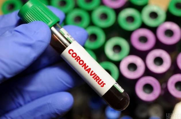 В Украине за сутки коронавирус диагностировали еще у 578 человек