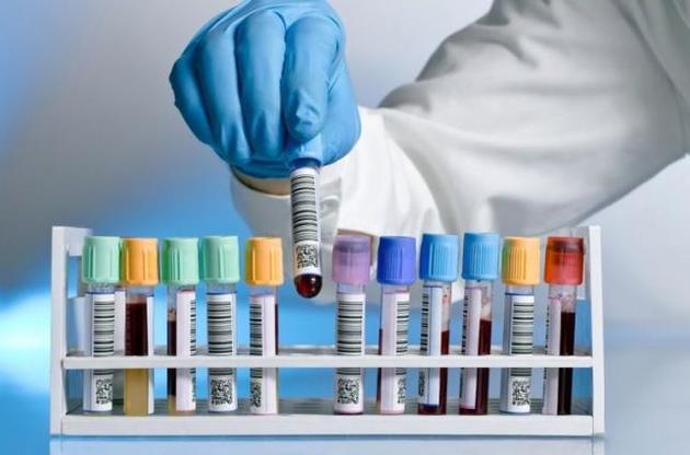 Анализ крови позволит выявить 50 видов рака