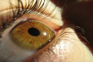 Лабораторно створена рогова оболонка ока дарує нової надії тим, хто втратив зір.