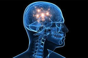 Мозг трудно изучить, а еще труднее понять,  почему он иногда прекращает работать