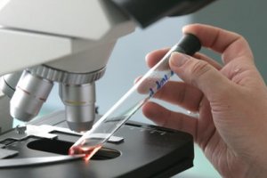 Вчені створили мікроорганізм, що вбиває ракові клітини