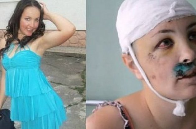 Пострадавшая до и после нападения