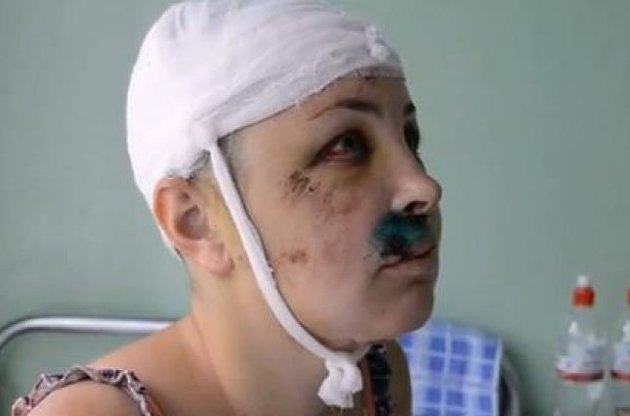 В автомобиле одного из подозреваемых найдена кровь изнасилованной Крашковой.