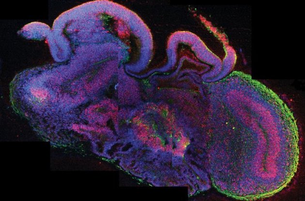 Ученые вырастили в пробирке миниатюрный мозг человека