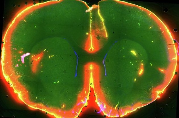 Ток красителя в мозге спящей мыши, который позволил выявить механизм очищения мозга от мусора
