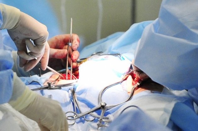 Проведено першу в світі операцію з імплантації повністю автономного штучного серця