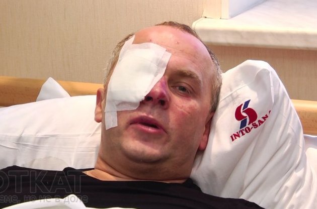 Після сутичок в Одесі Шуфрич потрапив у лікарню