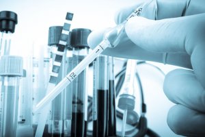 Українські онкологи розробили вакцину від раку