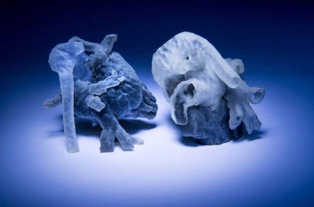 Распечатанные на 3D-принтере модели сердца позволяют хирургам подготовиться к операции