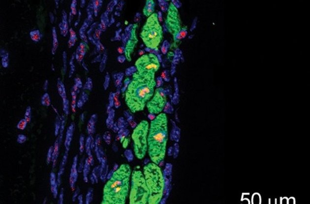 &laquo;Заплатки&raquo; не содержат чужеродных клеток, а, следовательно, не требуется применение иммуносупрессоров