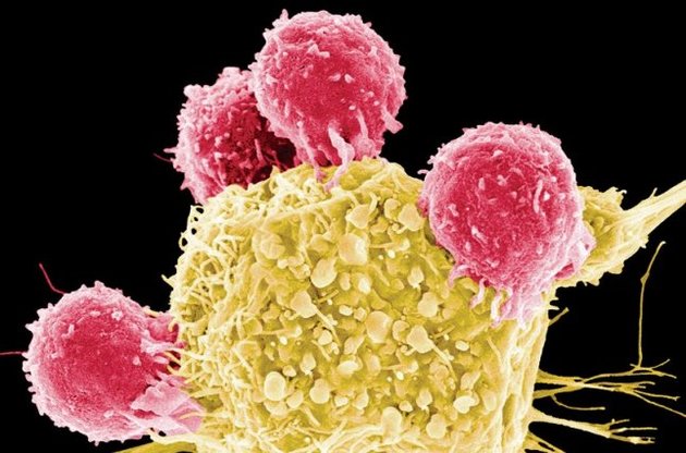 Медики планируют использовать "тепловые гранаты"  для лечения раковых опухолей