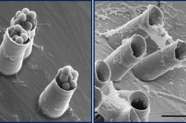 Діаметр &laquo;ядер&raquo; &mdash; один мікрометр