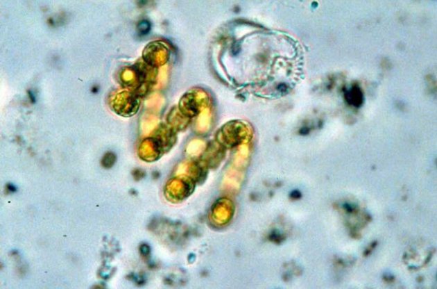 Ученые обнаружили "зрение" у цианобактерий