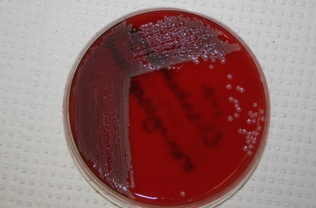 Мичиган &ndash; это уже второй американский штат, где зарегистрирована смерть от этой инфекции