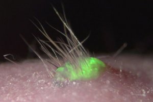 Ученые впервые вырастили волосы на искусственной коже