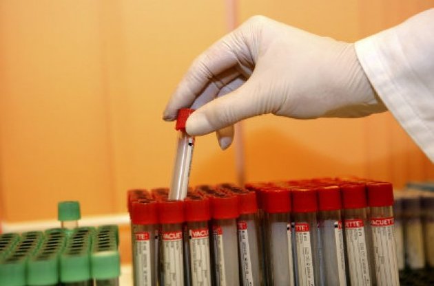 Во Франции зарегистрирован первый случай смерти от вируса Зика