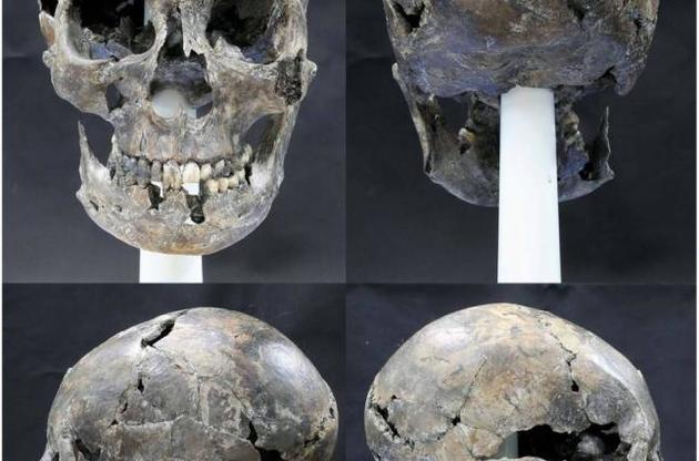 Археологи обнаружили в Южной Корее череп необычной формы