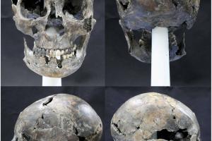 Археологи обнаружили в Южной Корее череп необычной формы