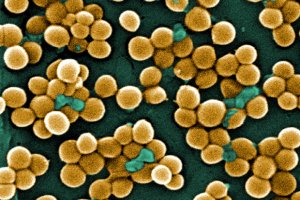 Ученые впервые обнаружили в человеческой слюне бактерии - паразиты бактерий