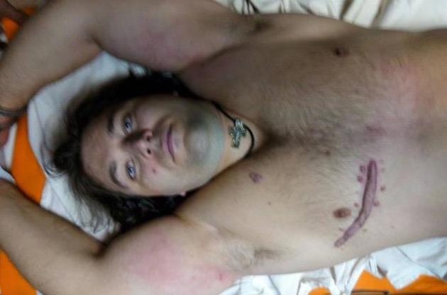 У злочинця стан середньої тяжкості