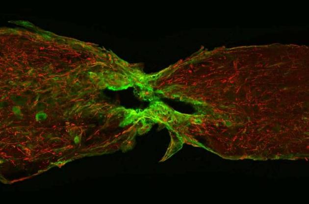 Исследователи изучили действие сигнального белка CTGF во время регенерации поврежденного спинного мозга