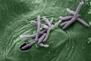 ВООЗ назвала найнебезпечніші для людини стійкі до антибіотиків бактерії