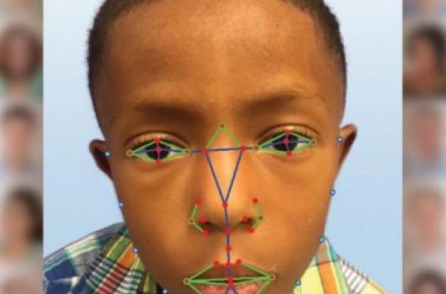 Вчені будуть діагностувати рідкісні генетичні захворювання за допомогою технології розпізнавання облич