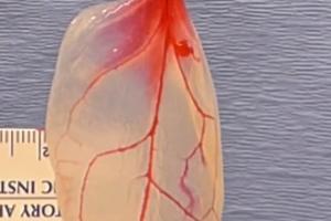 Вченим вдалося створити тканини серця людини з листя шпинату