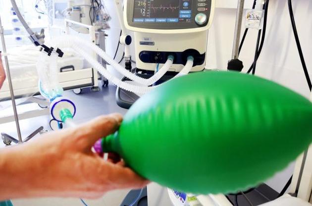 В Украине начали производить аналоги аппаратов ИВЛ