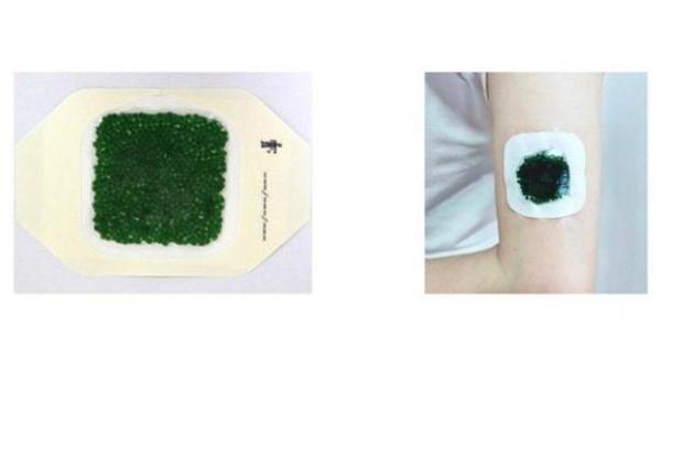 Пластрь допоміг загоїти хронічні рани при діабеті