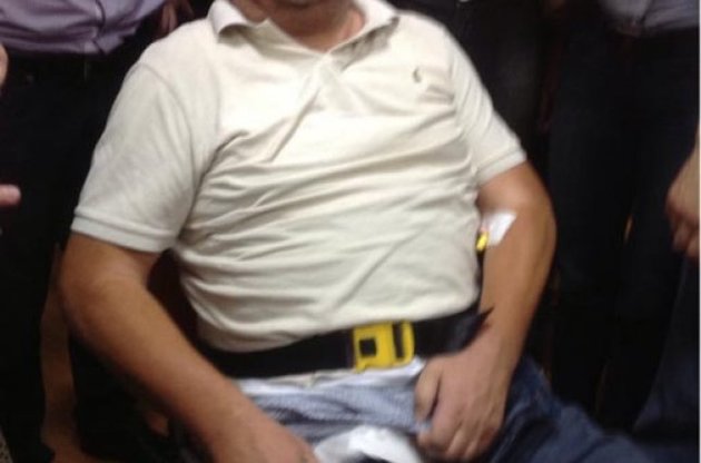 Мельник розстебнув штани і показав журналістам свою перев'язку