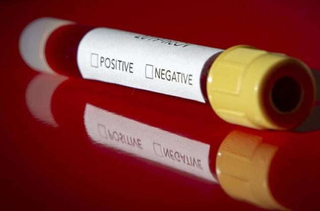 У США готовий до виробництва 45-хвилинний тест на коронавірус