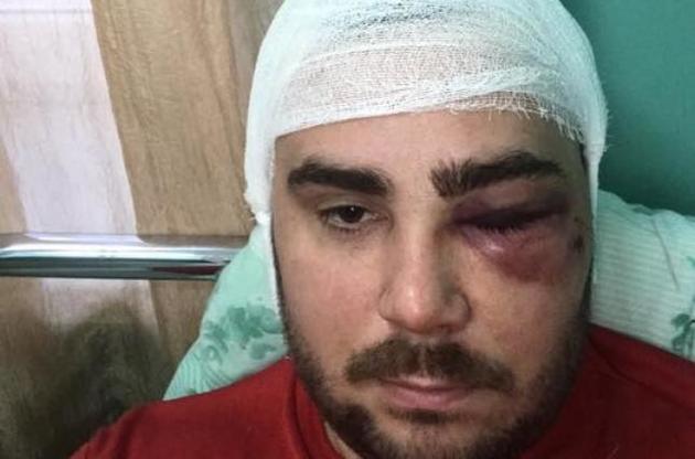 Нападнику на активіста загрожує до семи років за ґратами