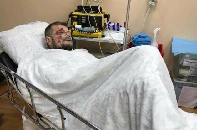 Пострадавшего от взрыва Мосийчука перевели в другую больницу