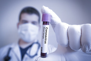 Зеленский разрешил лечить больных COVID-19 украицев экспериментальными лекарствами
