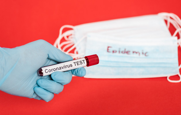 Зростання рівня захворюваності коронавірусом не слід пов'язувати лише з кількістю тестувань - Степанов 