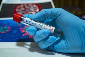 У Британії відновлюють тестування протималярійного препарату для профілактики COVID-19 