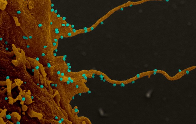 Зараженные коронавирусом клетки выращивают «щупальца» – ученые