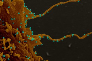 Зараженные коронавирусом клетки выращивают «щупальца» – ученые