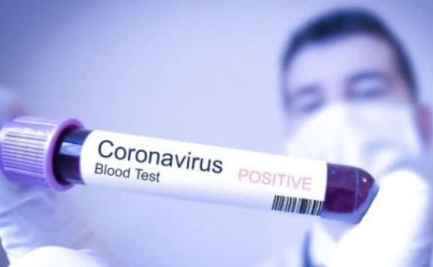 Тревожные цифры: больницы Ивано-Франковска не будут принимать пациентов с COVID-19