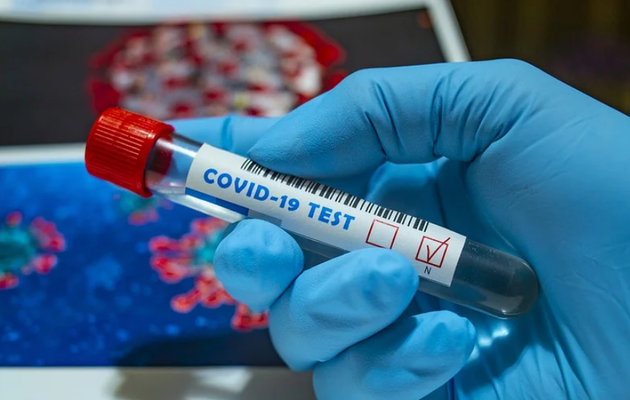 В Минздраве уточнили, кого бесплатно тестируют на коронавирус