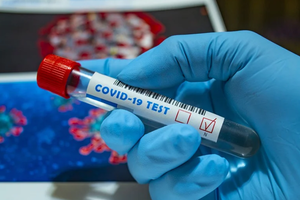 У МОЗ уточнили, кого безкоштовно тестують на коронавірус 