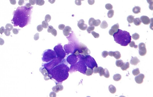 В США выкрали наработки по вакцине против коронавируса.