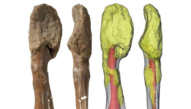 Динозавры болели раком: ученые нашли доказательства злокачественной остеосаркомы у древнего ящера
