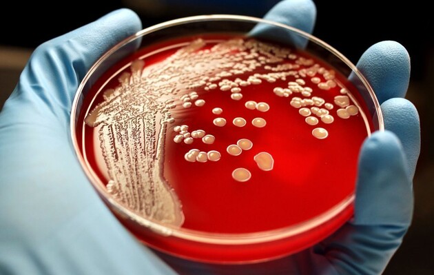 Одеський обласний лабораторний центр підтвердив випадок сибірської виразки.