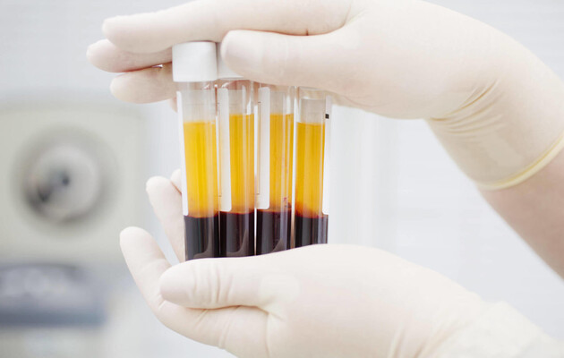 Лікування COVID-19 плазмою крові перехворілих є експериментальним – ВООЗ 