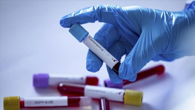 В Україні досліджують чотири препарати від коронавірусу - Степанов 