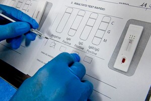 В Украине готовят тест, который с одного образца определит грипп или COVID-19 у пациента