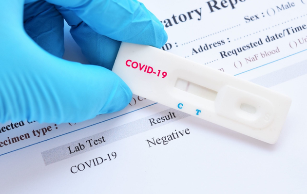 Правительство выделило почти 253 млн на оборудование и материалы для тестирования на коронавирус