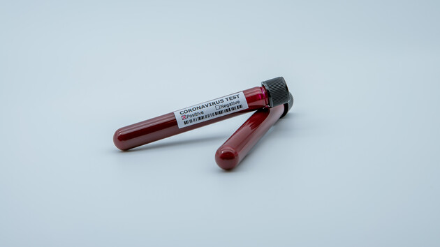 Страны одна за другой сообщают о росте заболеваемости